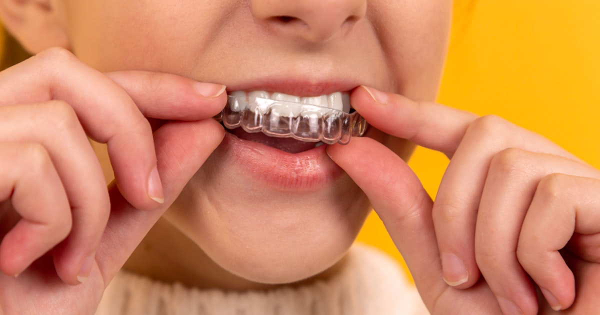 Bruxismo: Causas, Sintomas e Tratamentos para Proteger Seus Dentes